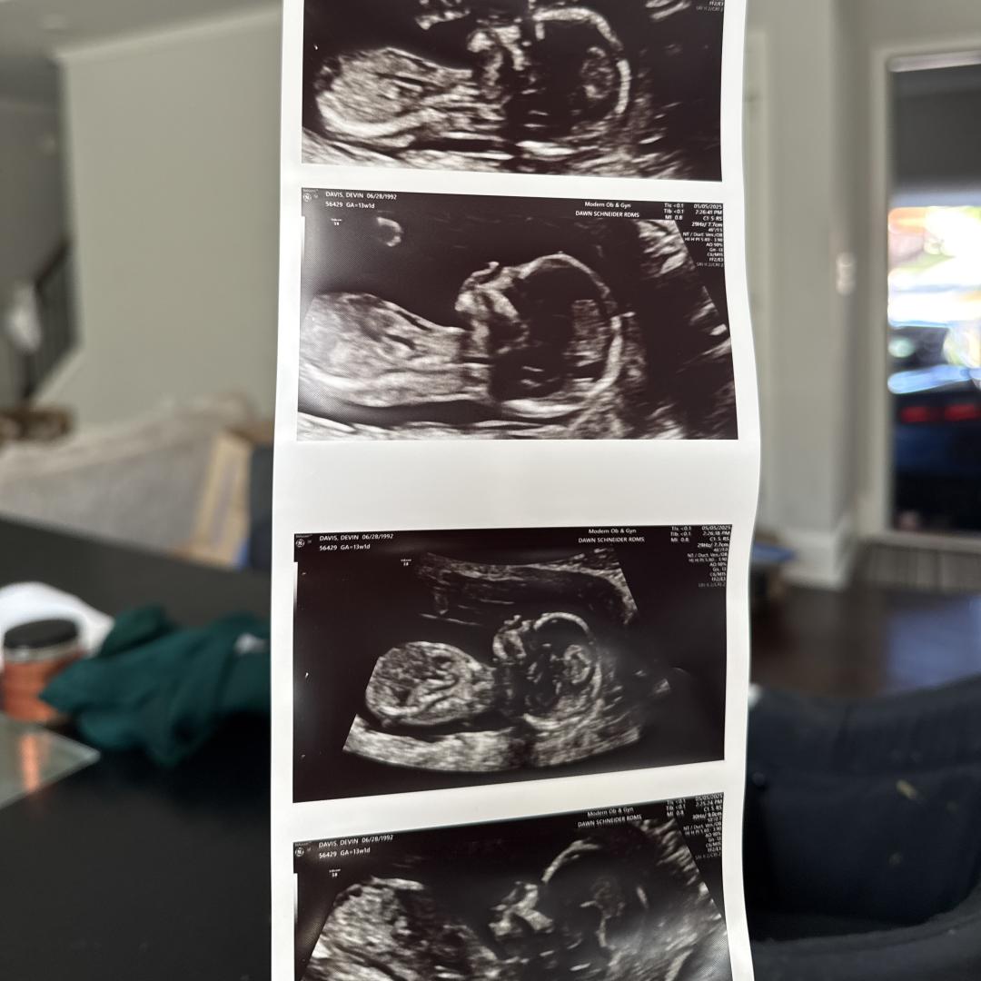 Photo shared by Devin for their Babylist baby registry.