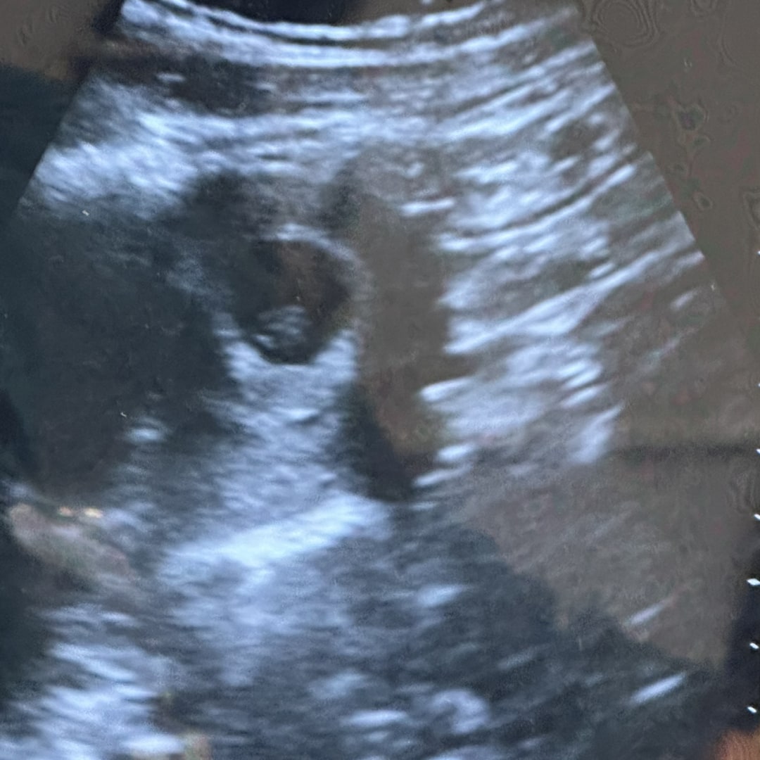Photo shared by Cristina for their Babylist baby registry.