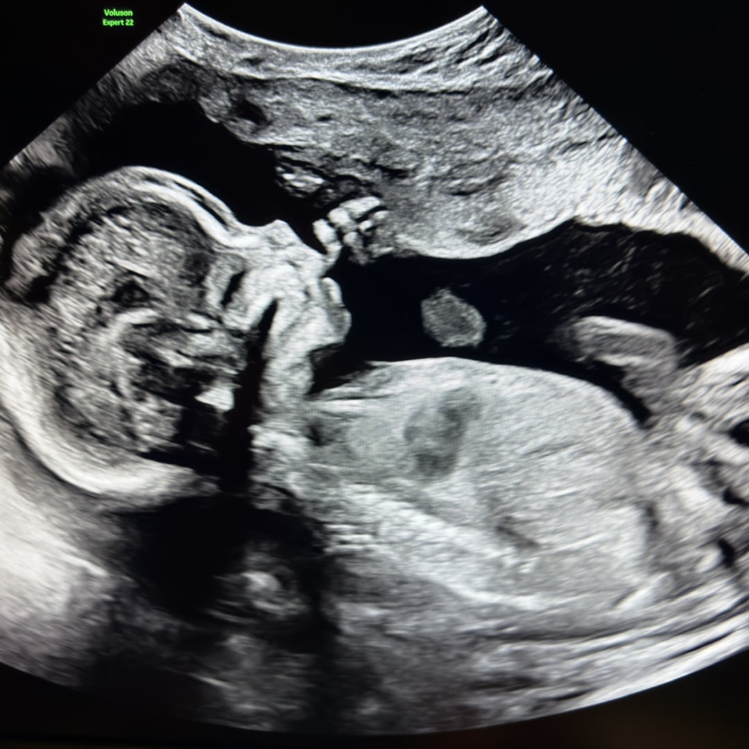Photo shared by Francisca for their Babylist baby registry.