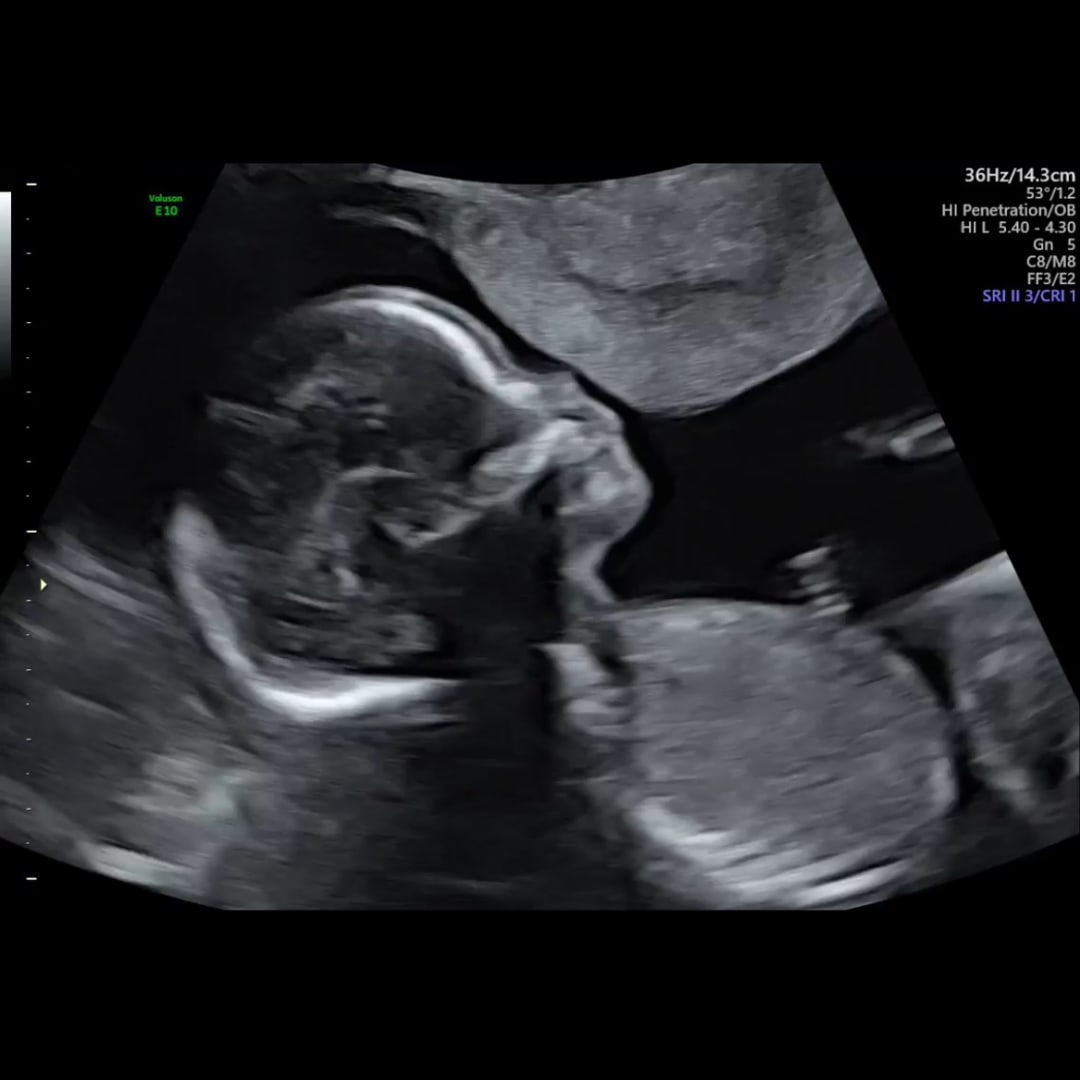 Photo shared by Jessica for their Babylist baby registry.