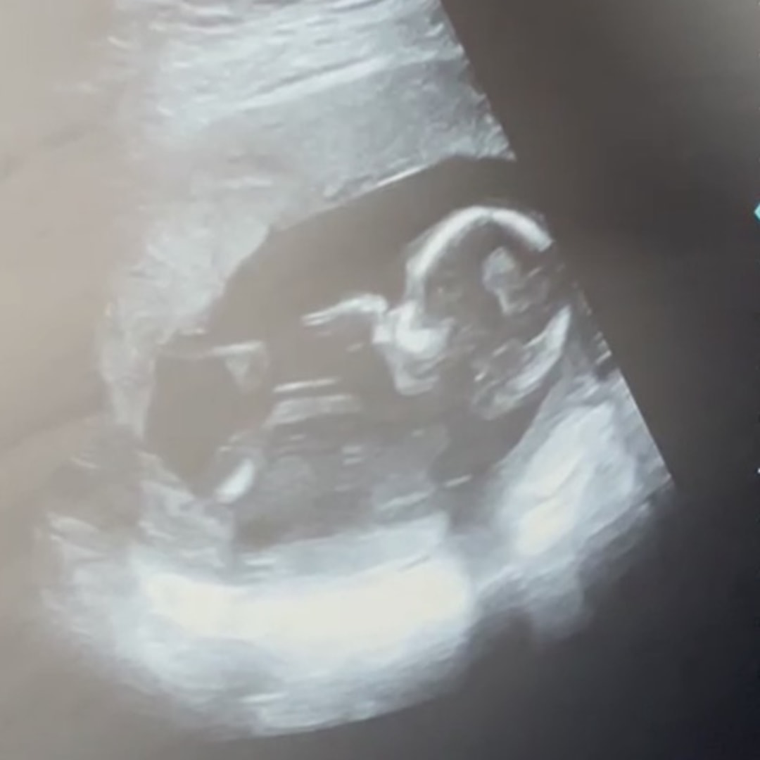 Photo shared by Yudit for their Babylist baby registry.
