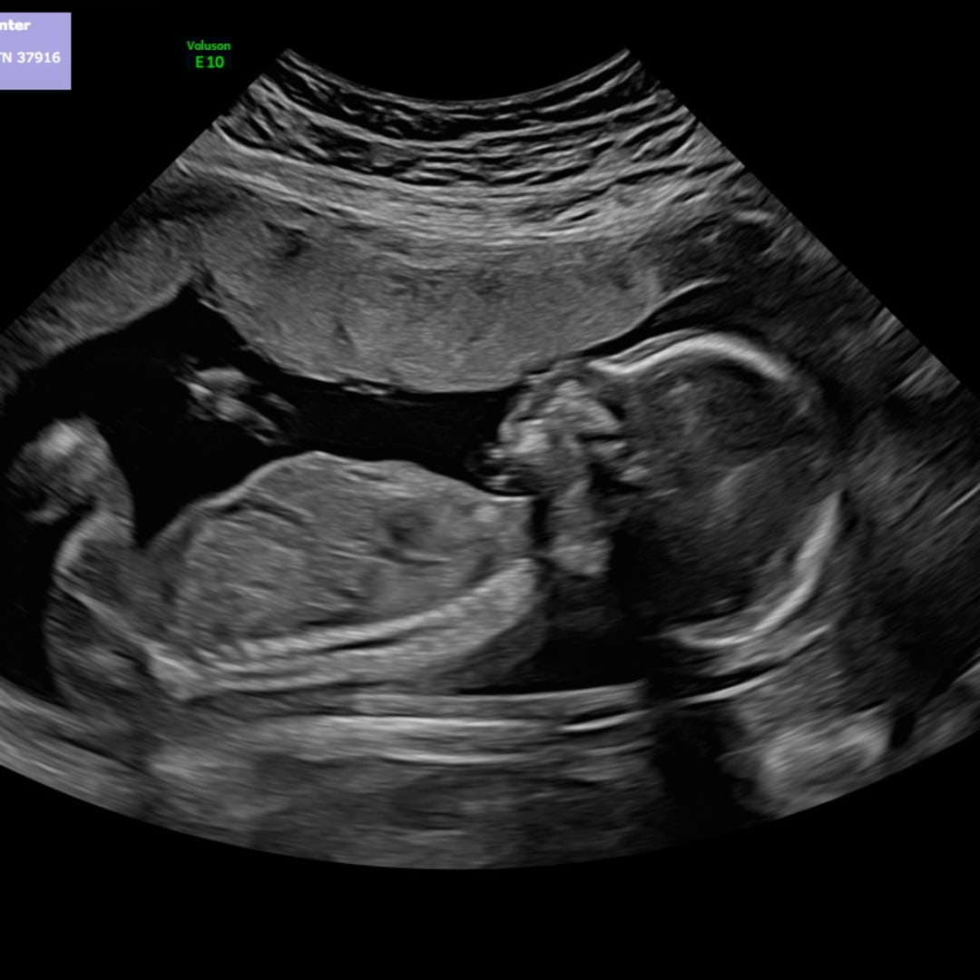 Photo shared by Liz for their Babylist baby registry.