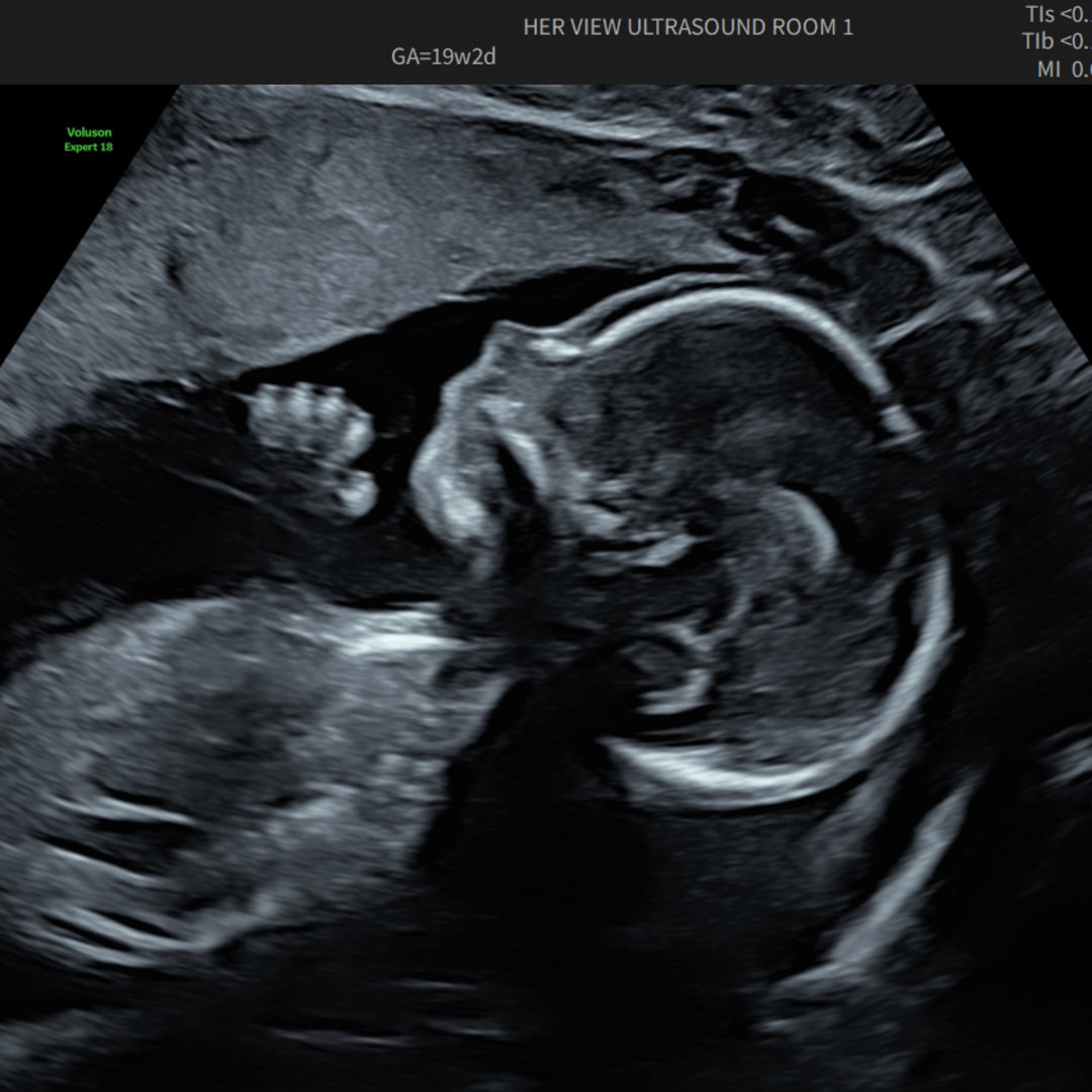 Photo shared by Angela for their Babylist baby registry.