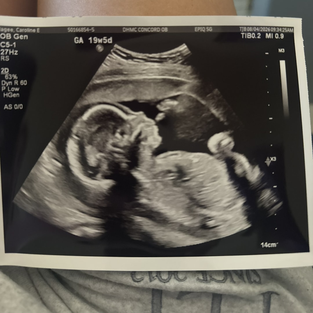 Photo shared by Caroline for their Babylist baby registry.