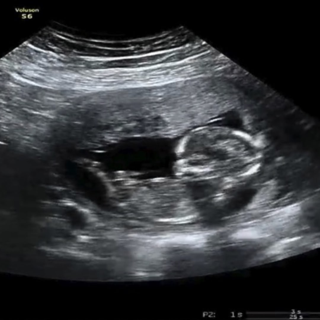 Photo shared by Hailey for their Babylist baby registry.