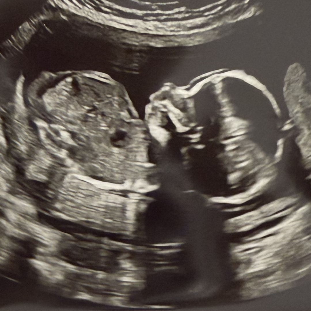 Photo shared by Savannah for their Babylist baby registry.