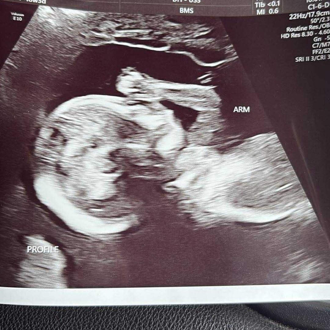 Photo shared by Caitlyn for their Babylist baby registry.