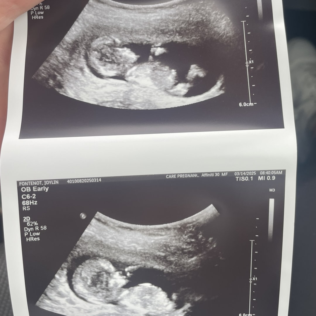 Photo shared by Joylin for their Babylist baby registry.