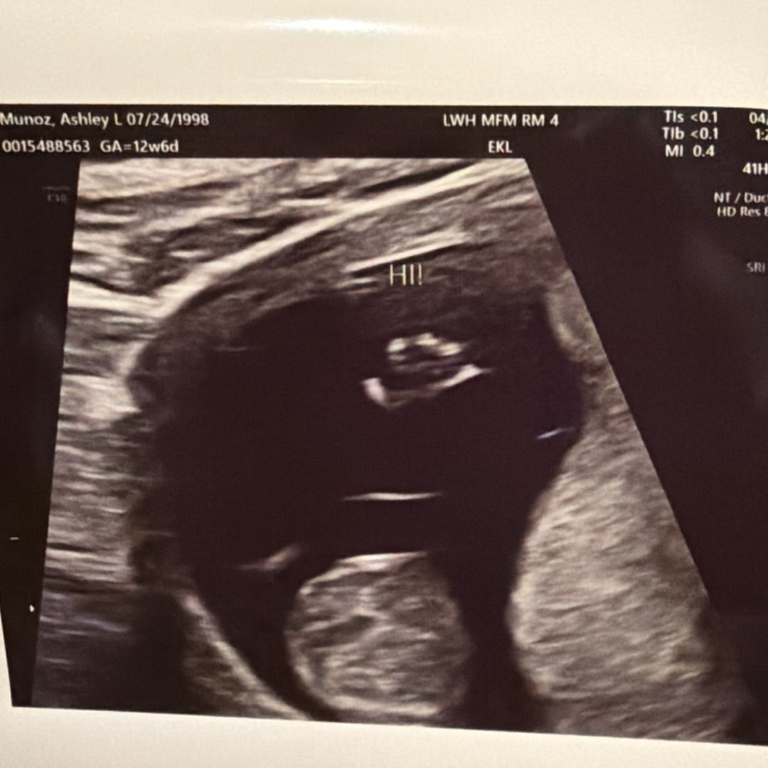 Photo shared by Ashley for their Babylist baby registry.