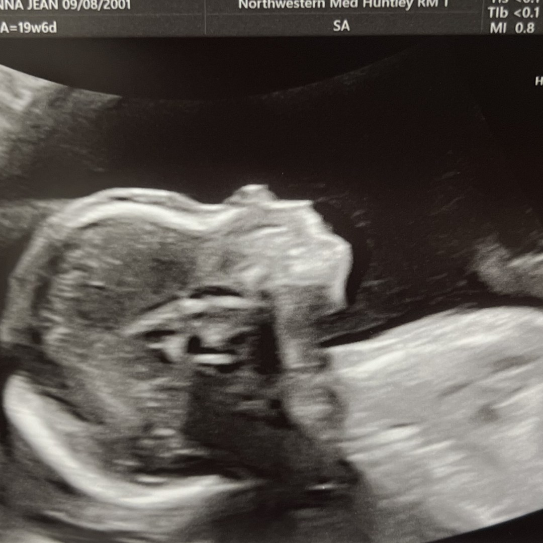 Photo shared by Brianna for their Babylist baby registry.