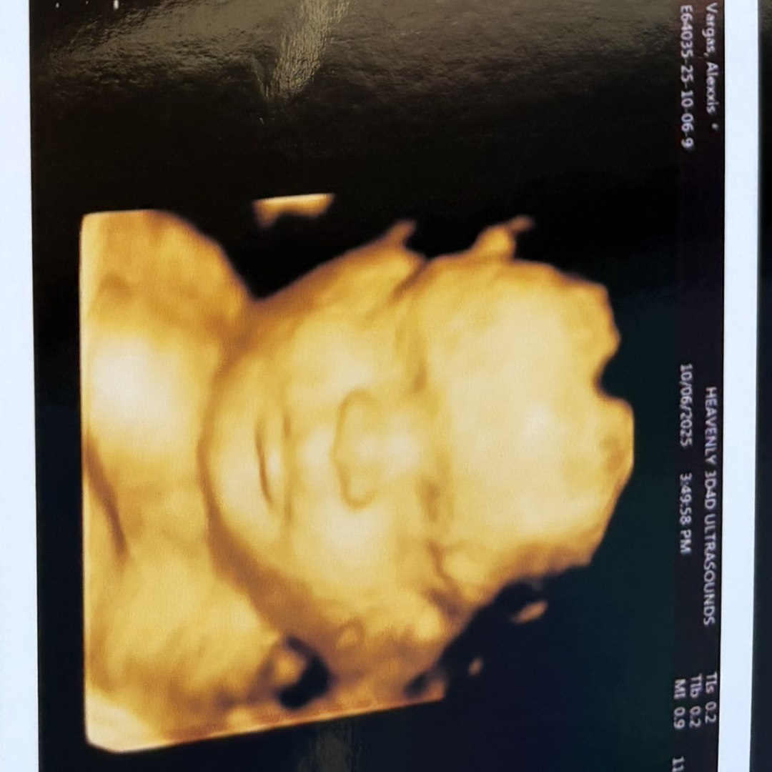 Photo shared by Alexxis for their Babylist baby registry.