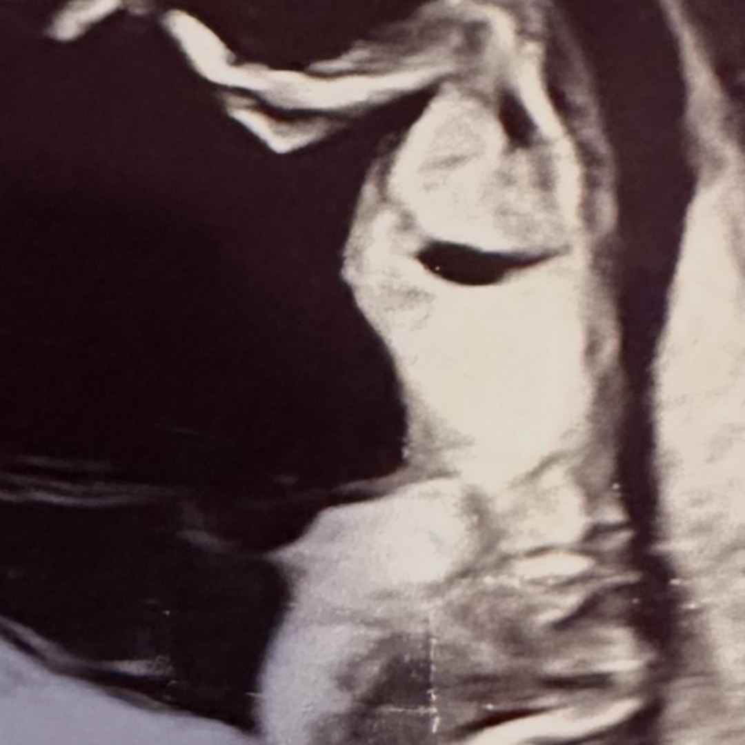 Photo shared by Siobhan for their Babylist baby registry.