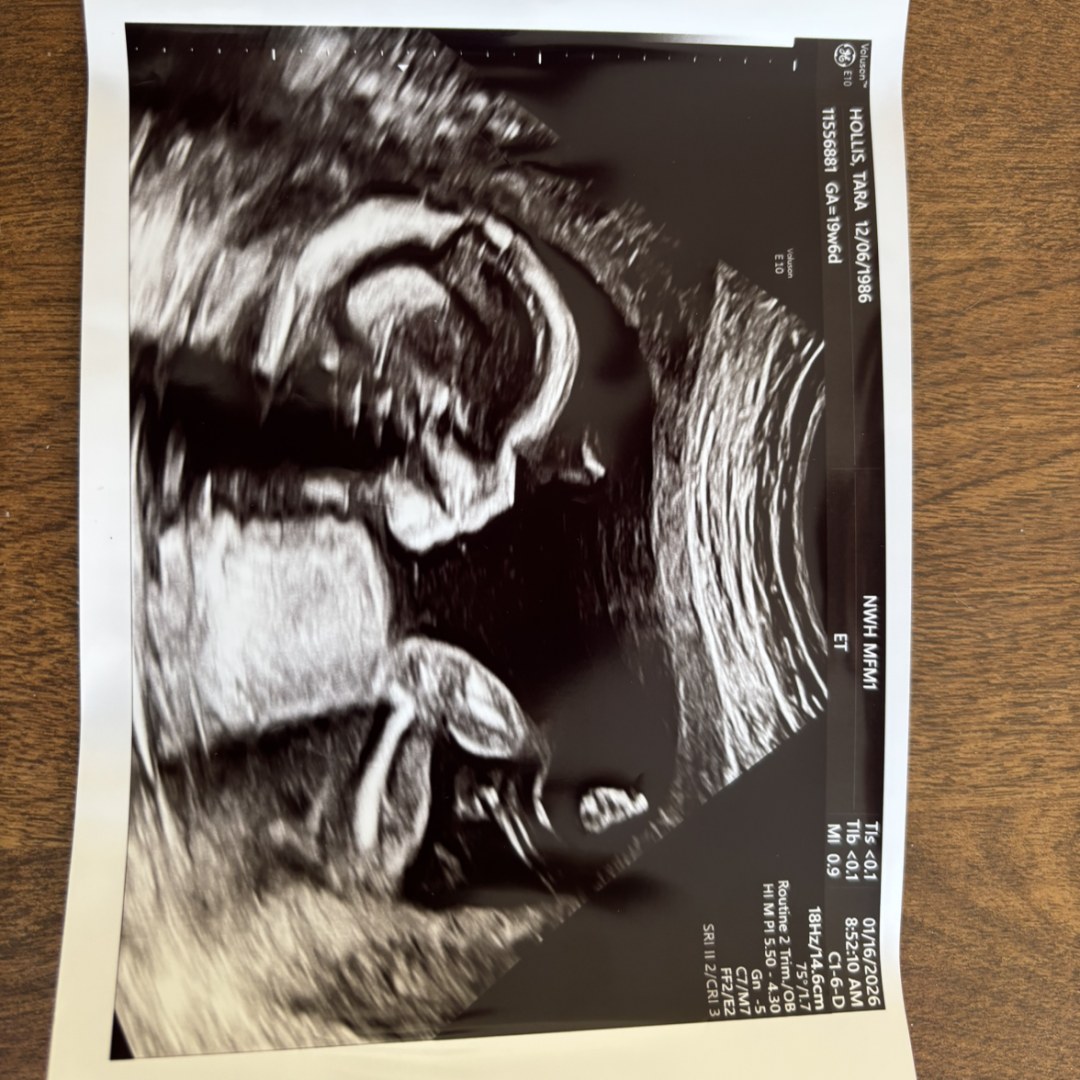 Photo shared by Tara for their Babylist baby registry.