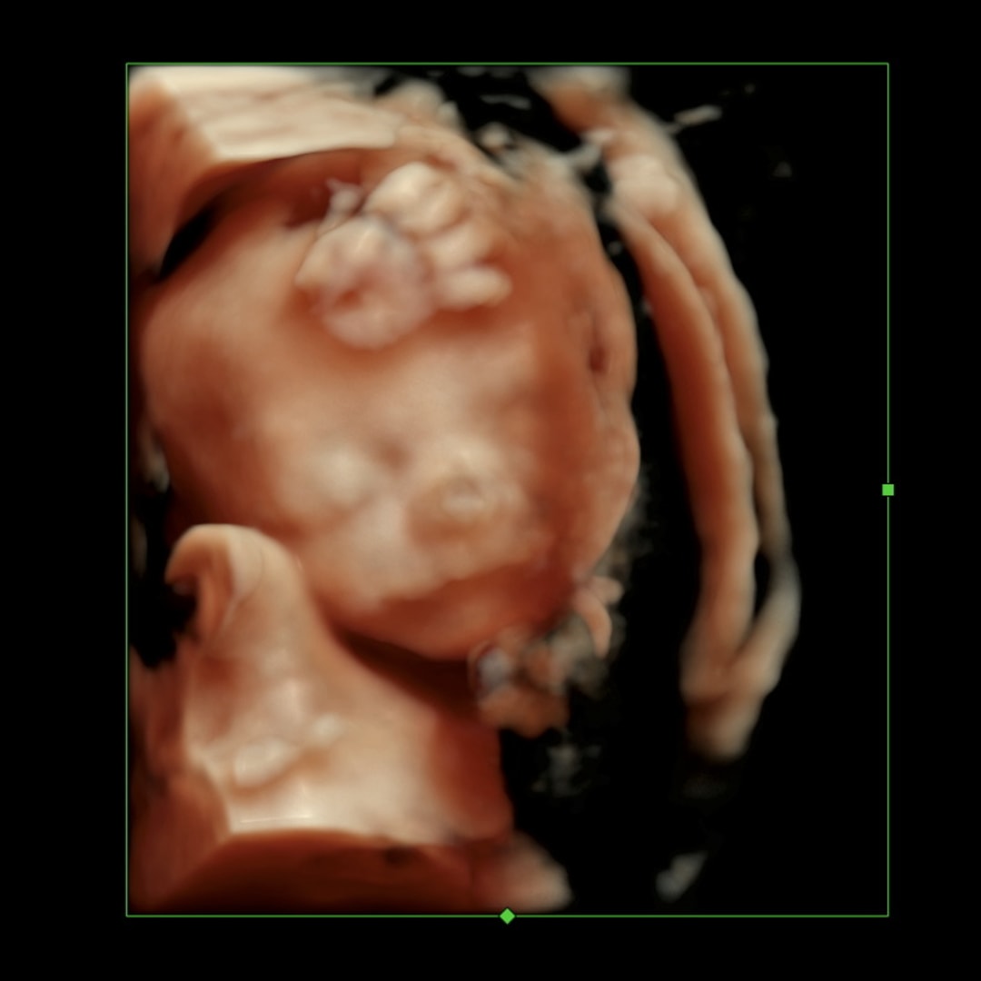 Photo shared by Avery for their Babylist baby registry.