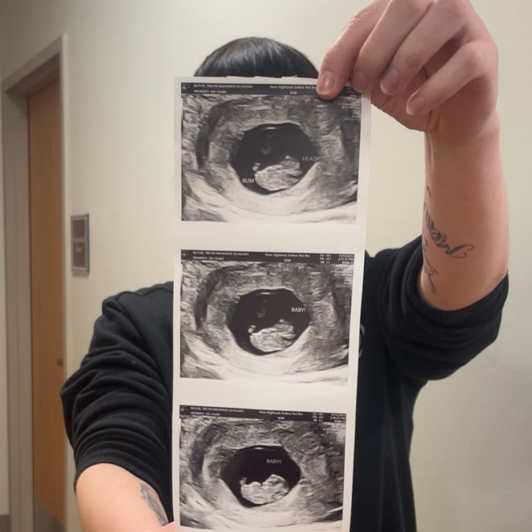 Photo shared by Trelyn for their Babylist baby registry.