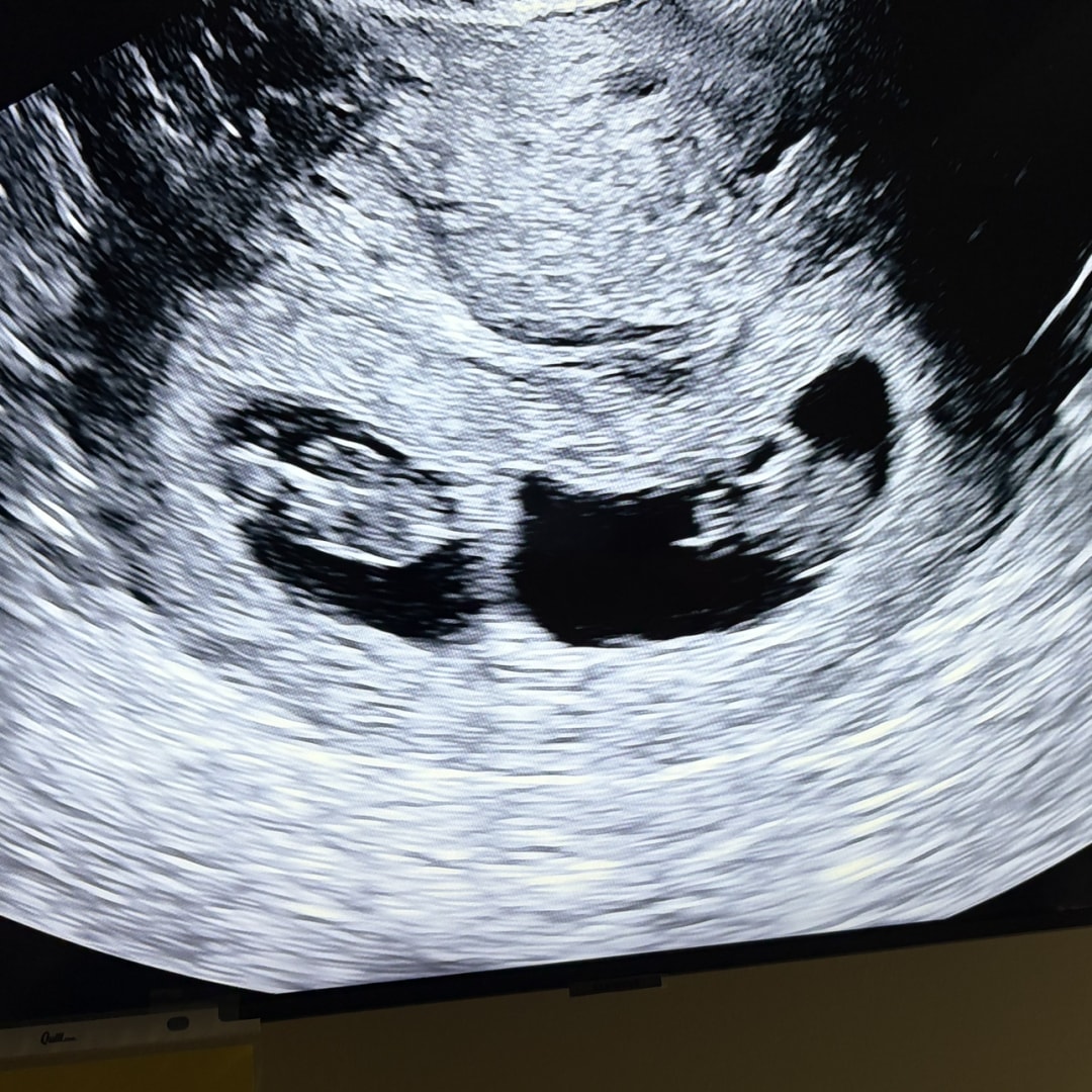 Photo shared by Hira for their Babylist baby registry.