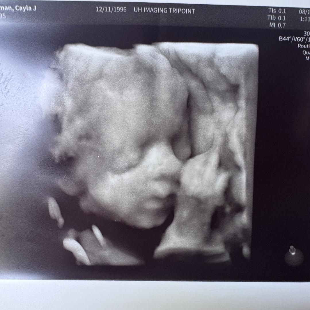 Photo shared by Cayla for their Babylist baby registry.