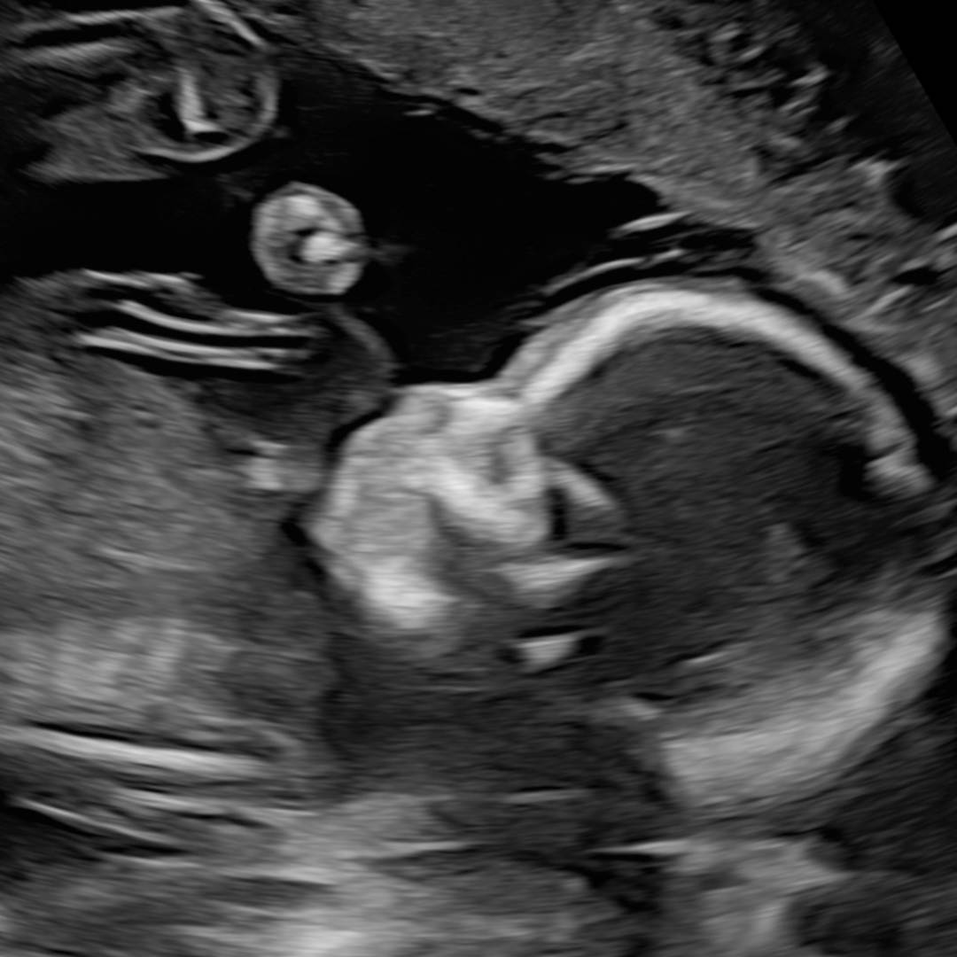 Photo shared by Rebecca for their Babylist baby registry.
