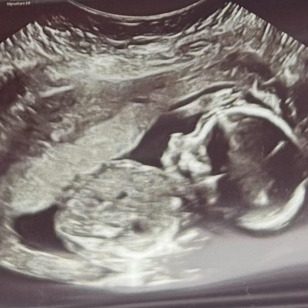 Photo shared by Erika for their Babylist baby registry.