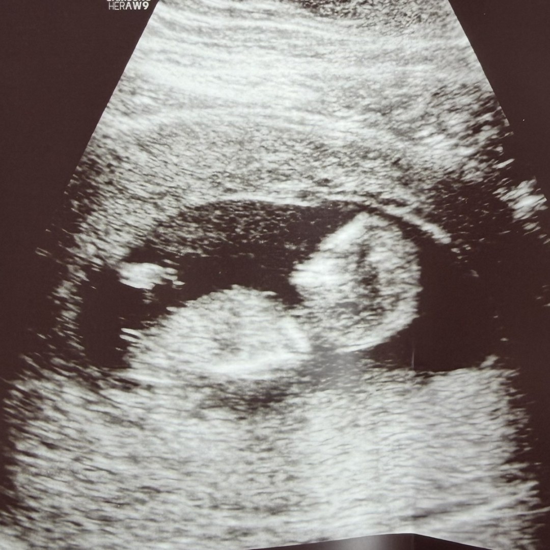 Photo shared by Shelby for their Babylist baby registry.