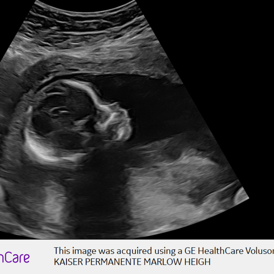 Photo shared by Tatiana for their Babylist baby registry.