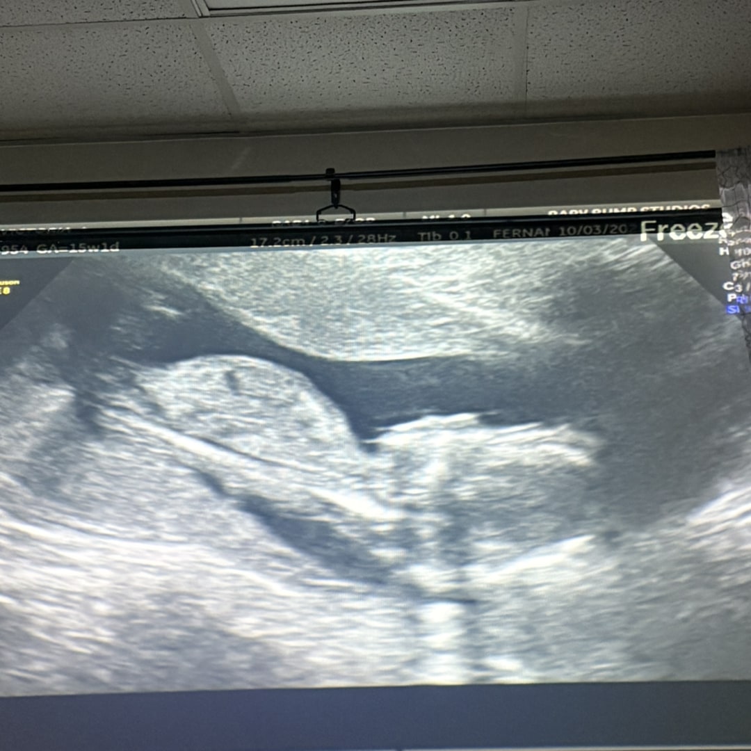 Photo shared by Victoria for their Babylist baby registry.