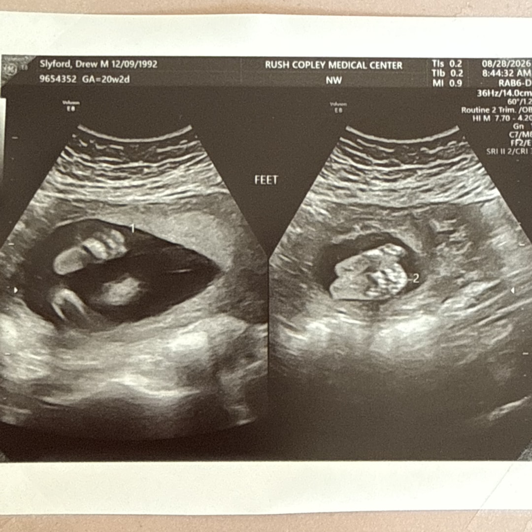 Photo shared by Drew for their Babylist baby registry.