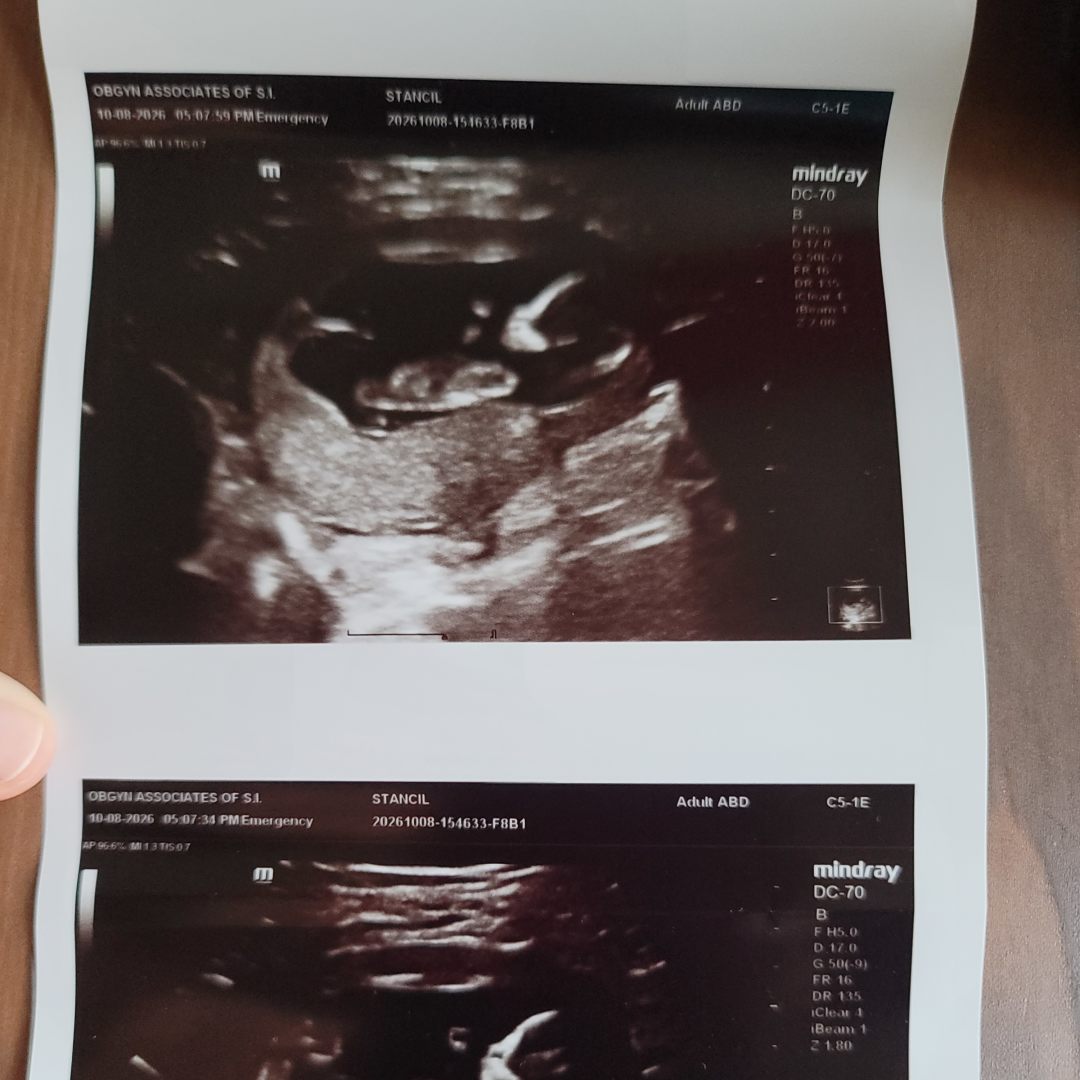 Photo shared by Lesley for their Babylist baby registry.