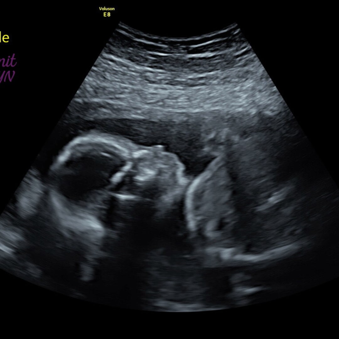 Photo shared by Brianna for their Babylist baby registry.
