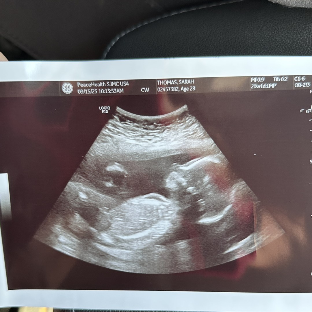 Photo shared by Sarah for their Babylist baby registry.