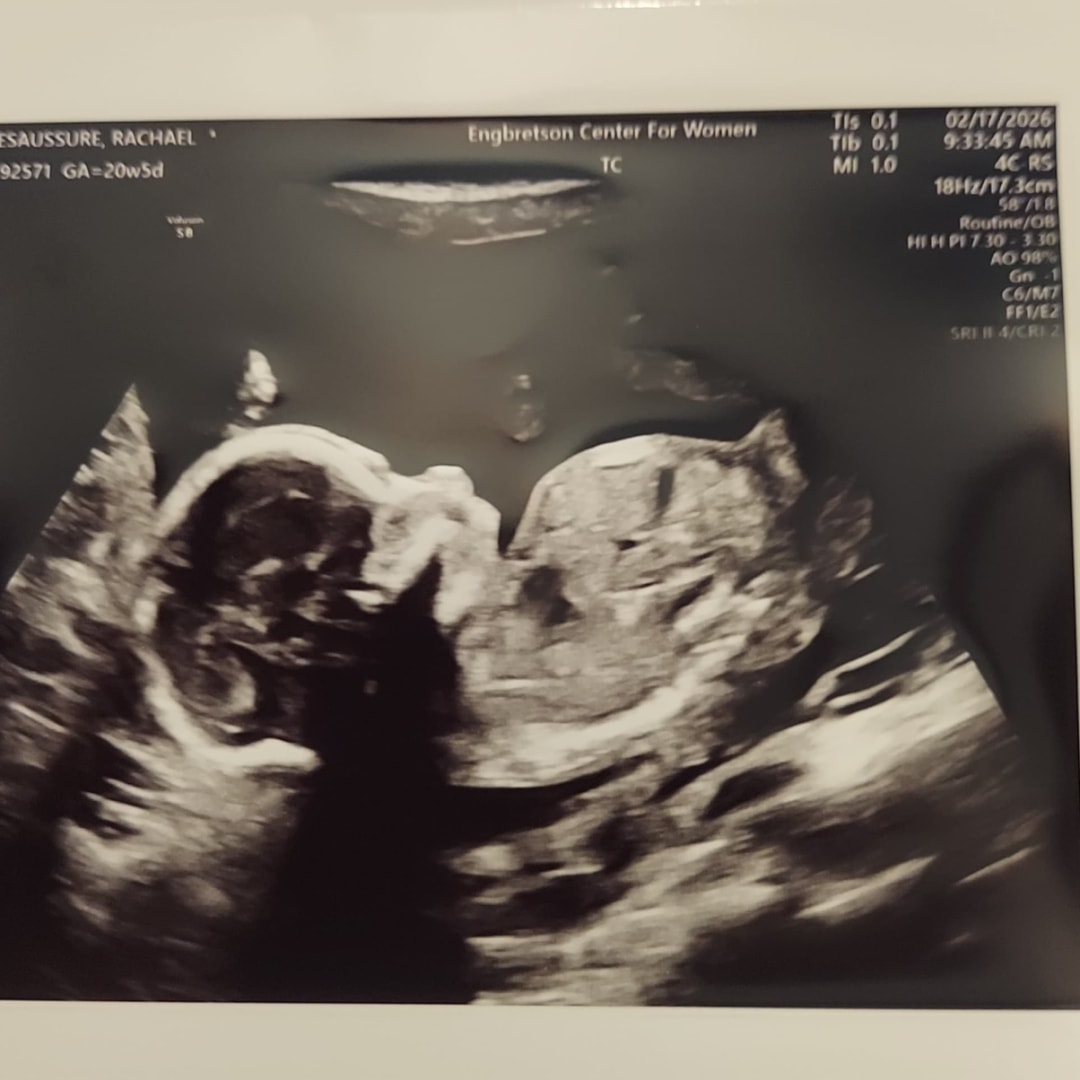 Photo shared by Rachael for their Babylist baby registry.