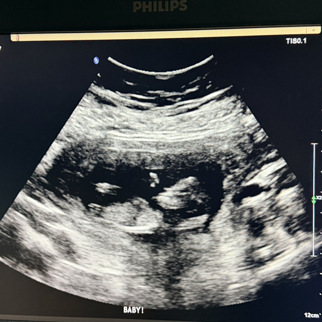 Photo shared by Rebecca for their Babylist baby registry.