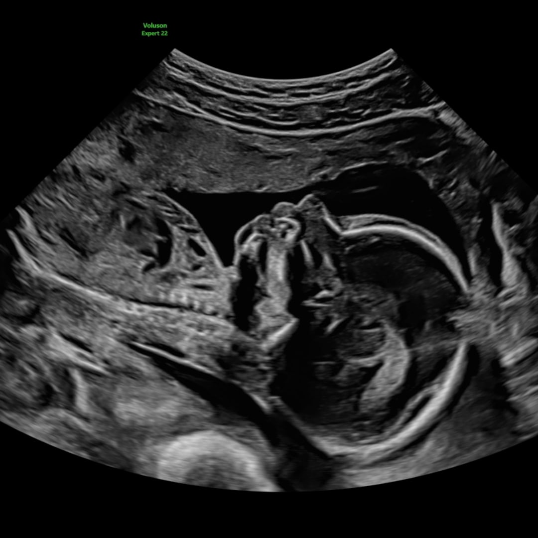 Photo shared by Edelina for their Babylist baby registry.