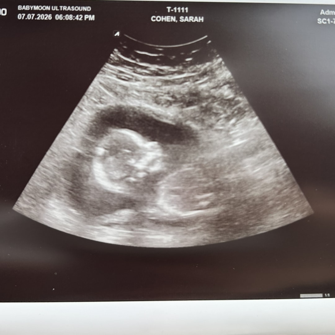 Photo shared by Sarah for their Babylist baby registry.