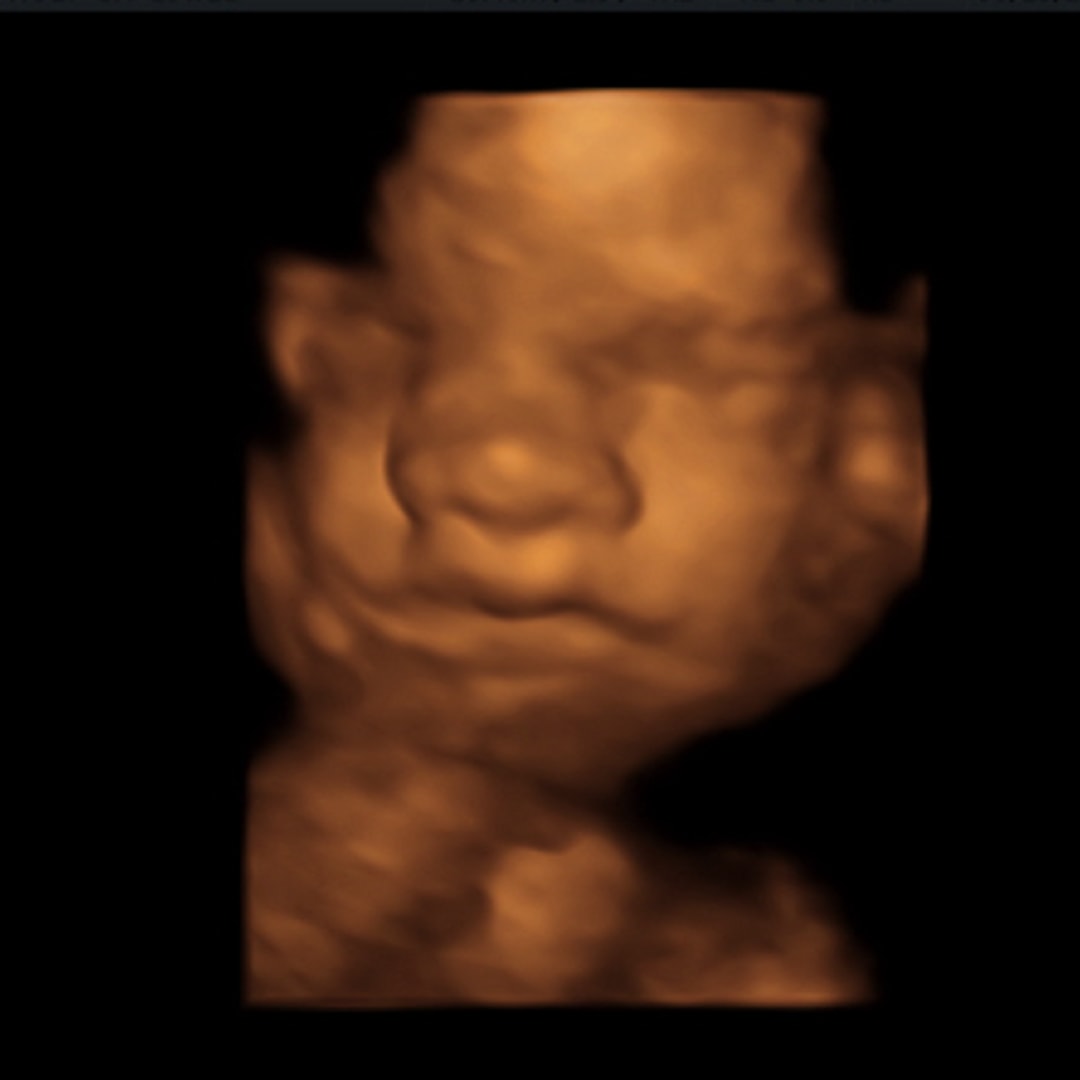Photo shared by Lauren for their Babylist baby registry.