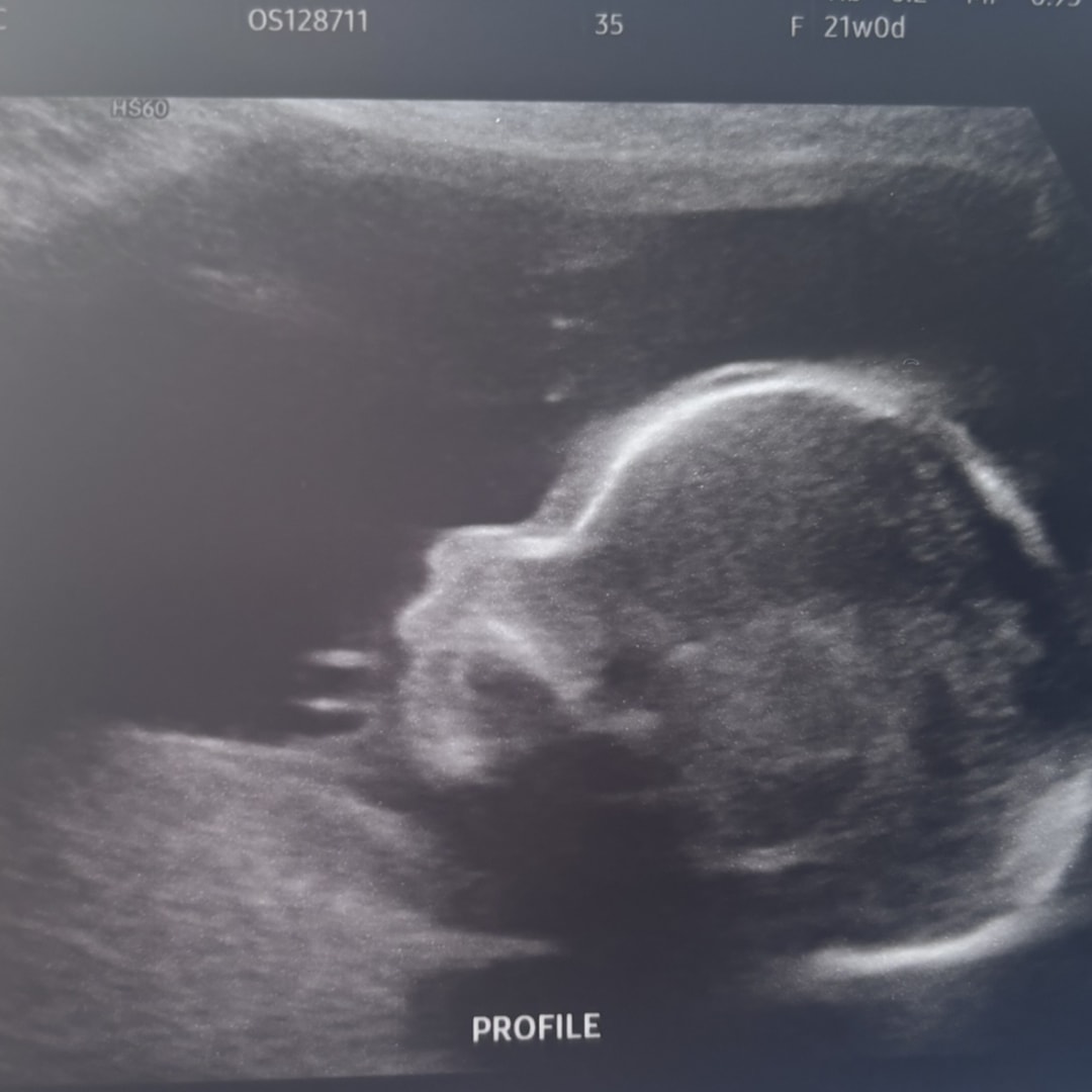 Photo shared by Stephanie for their Babylist baby registry.