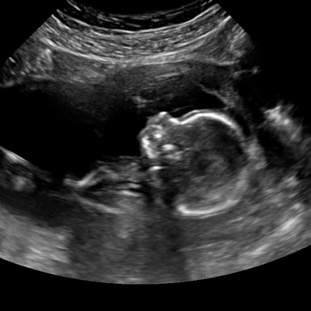 Photo shared by Haley for their Babylist baby registry.