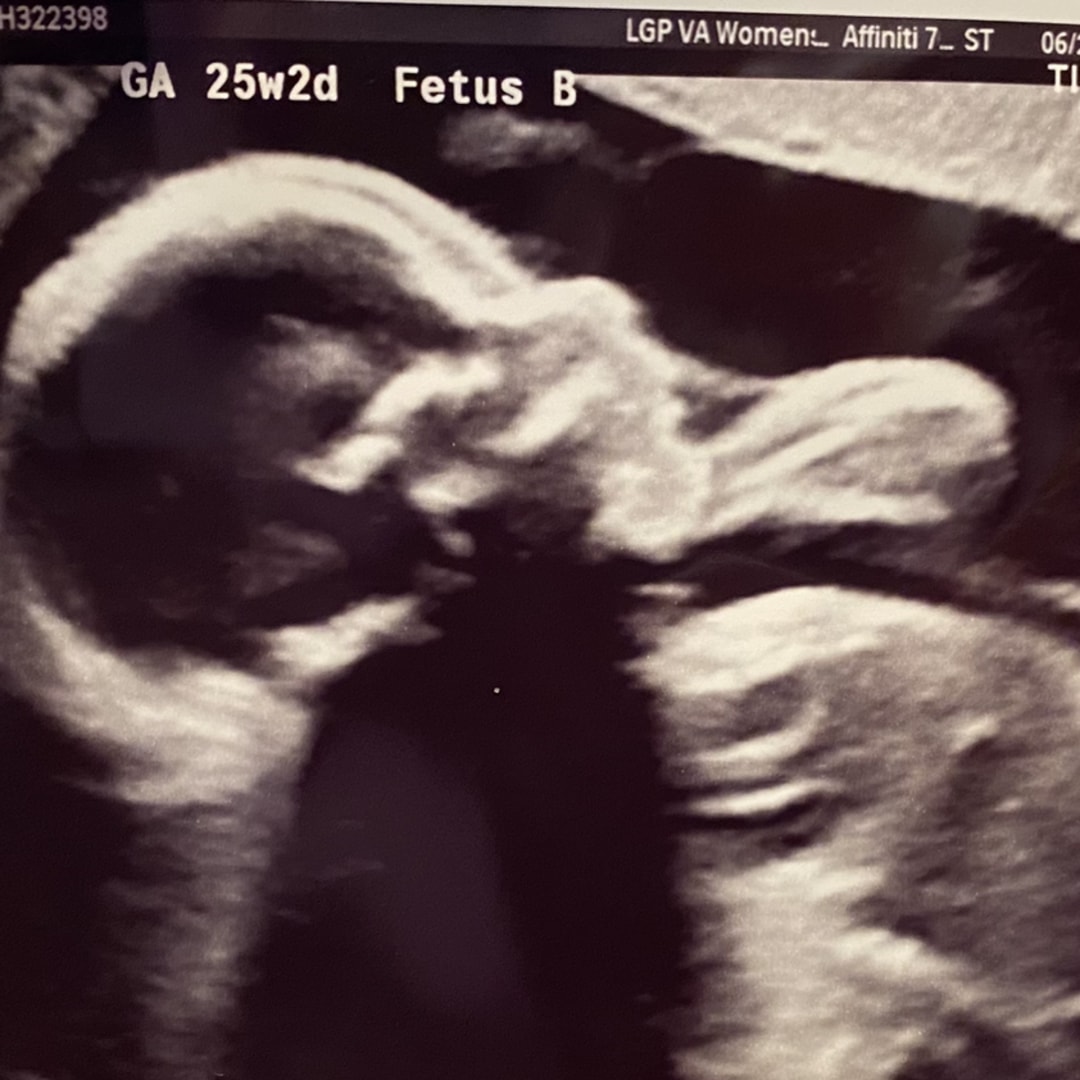 Photo shared by Johanna for their Babylist baby registry.