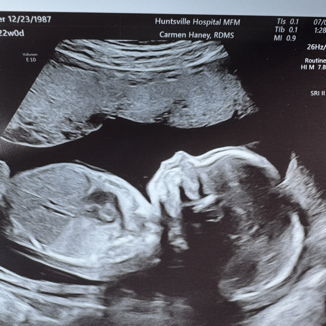 Photo shared by Kelly for their Babylist baby registry.