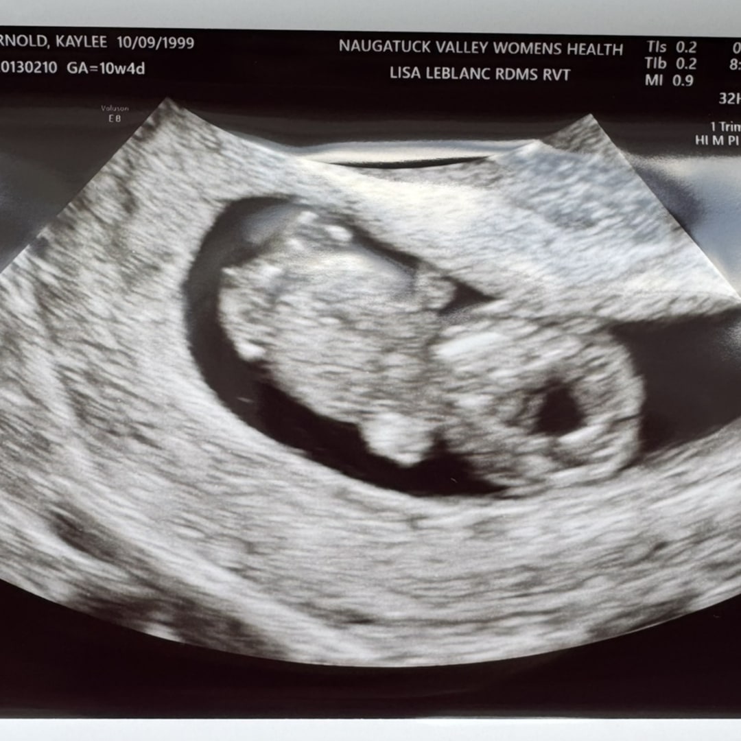 Photo shared by Kaylee for their Babylist baby registry.