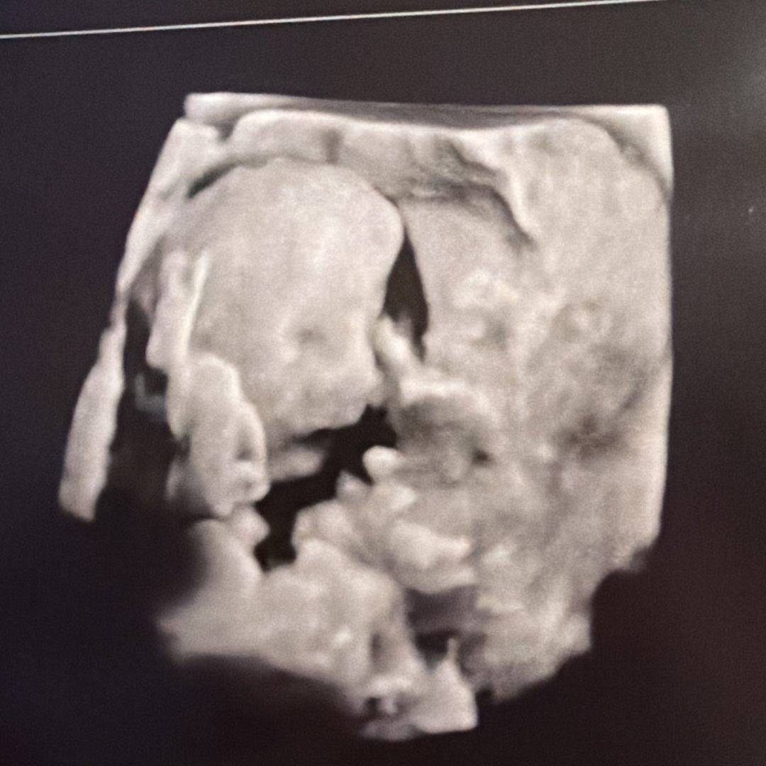 Photo shared by Mariah for their Babylist baby registry.
