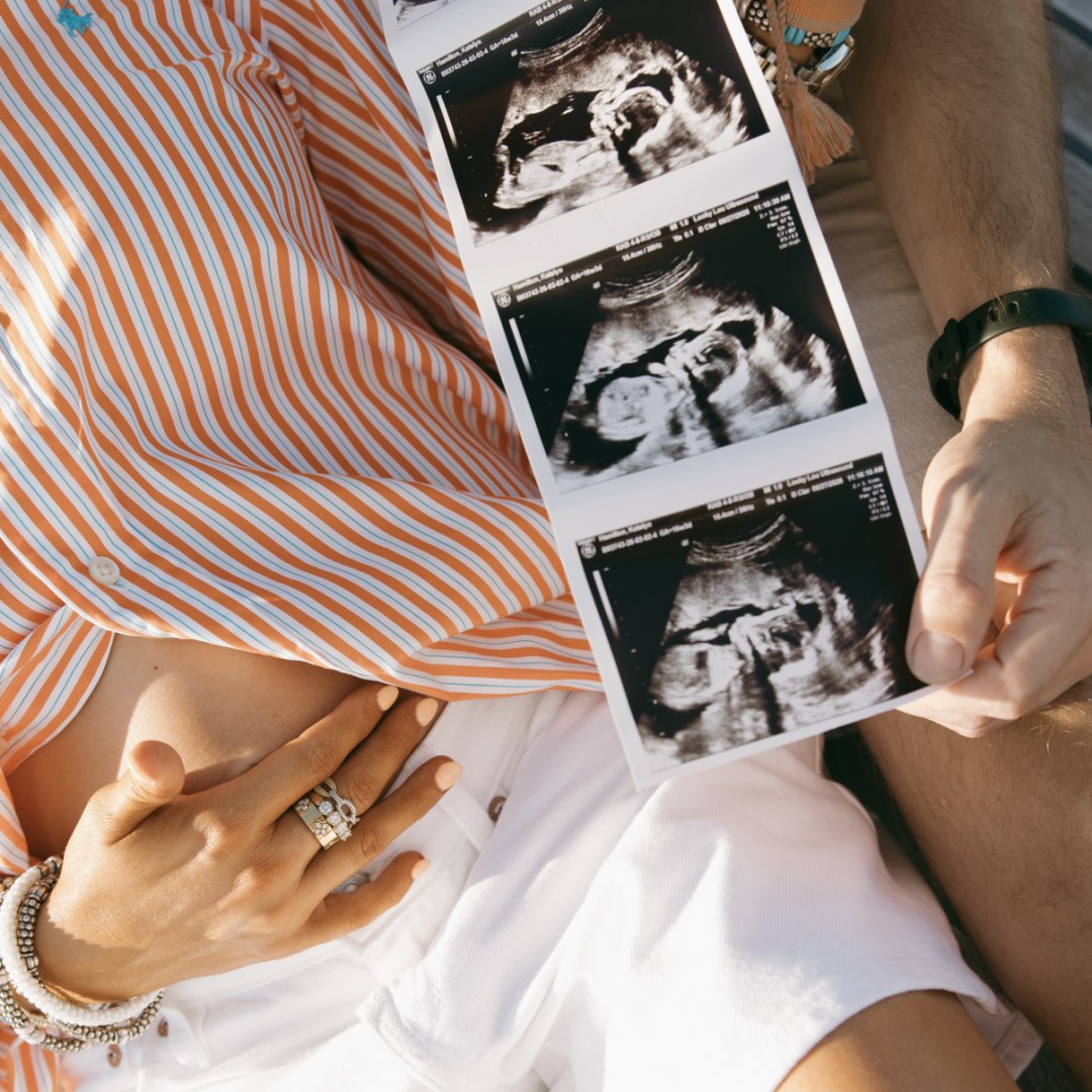 Photo shared by Kate for their Babylist baby registry.