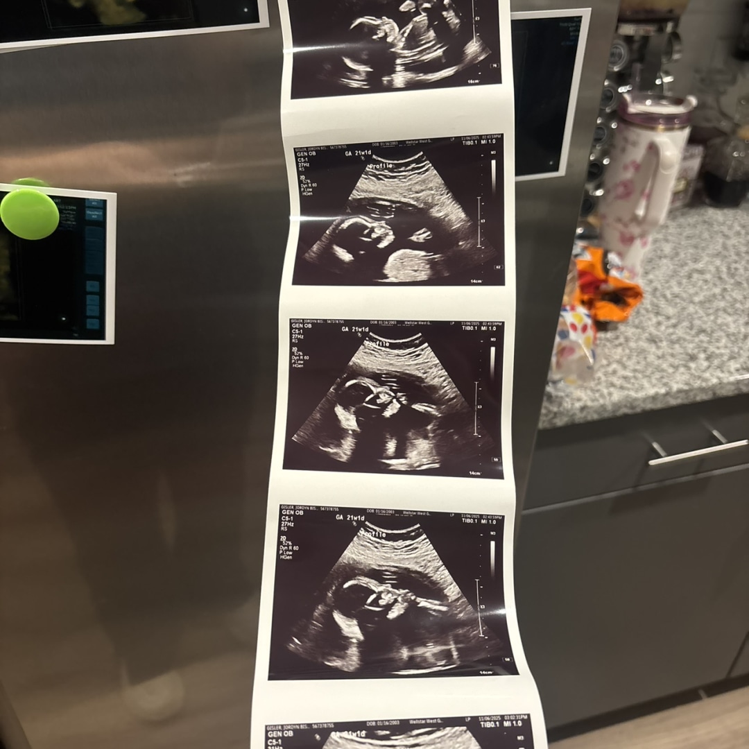 Photo shared by Jordyn for their Babylist baby registry.