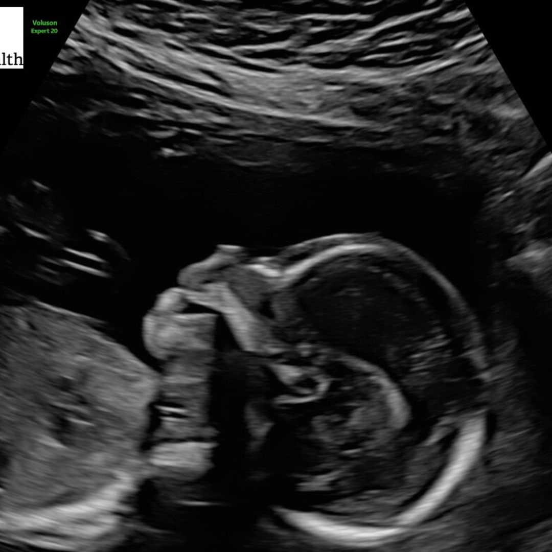 Photo shared by Emma for their Babylist baby registry.