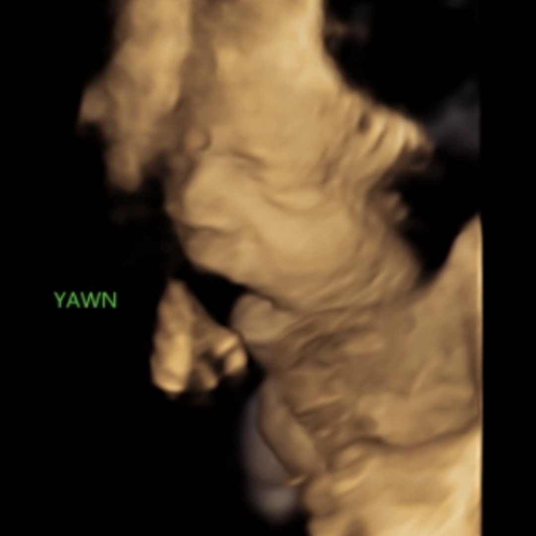 Photo shared by Mary for their Babylist baby registry.