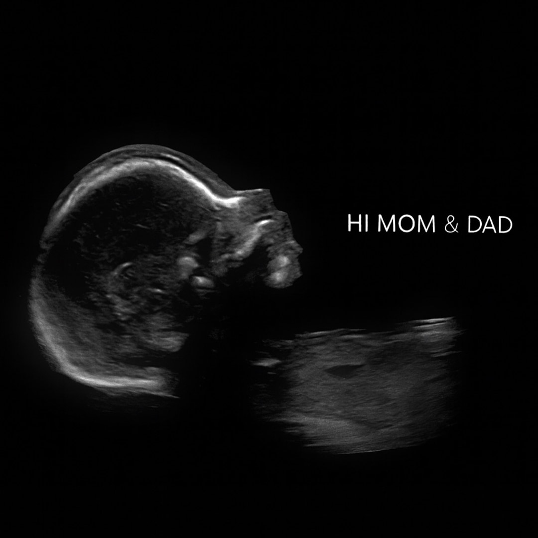Photo shared by Damaris for their Babylist baby registry.