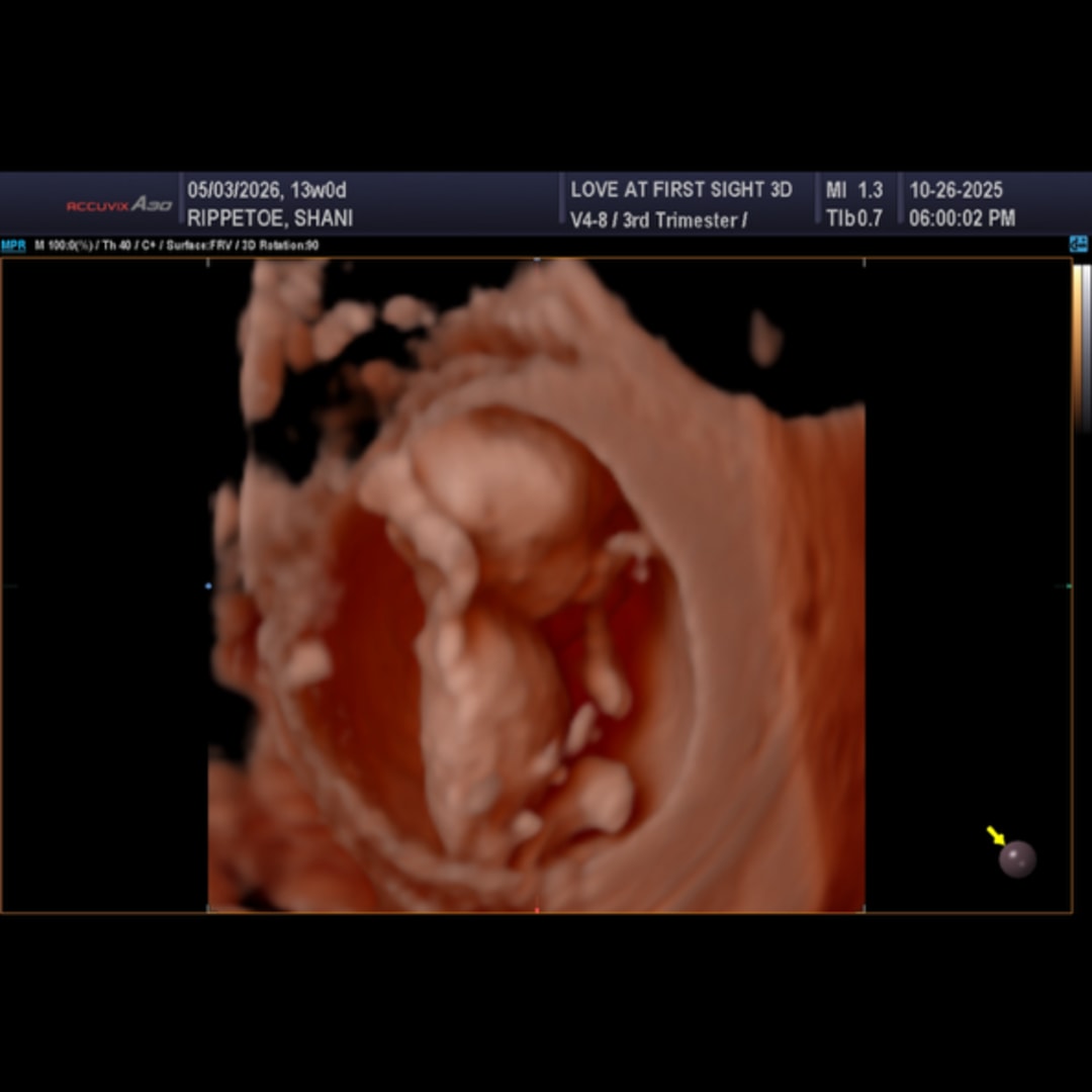 Photo shared by Shani for their Babylist baby registry.