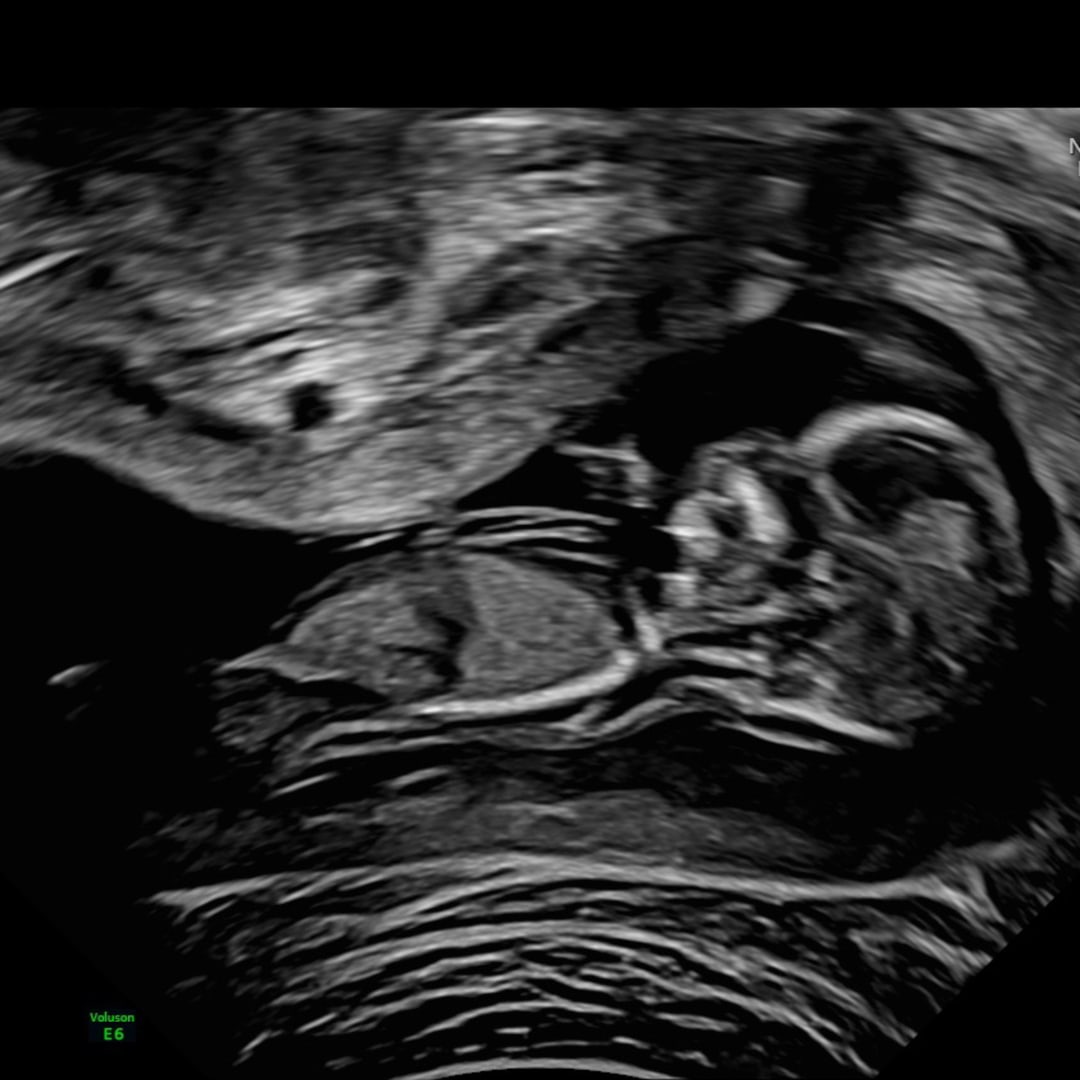 Photo shared by Angela for their Babylist baby registry.