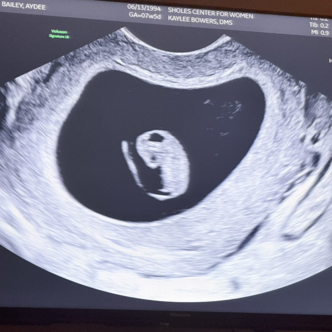 Photo shared by Aydee for their Babylist baby registry.