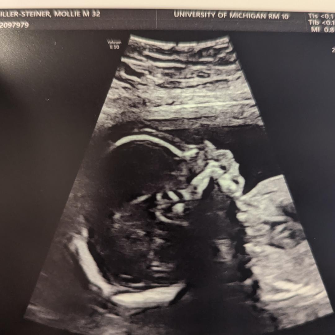 Photo shared by Mollie for their Babylist baby registry.